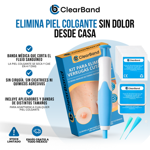 ClearBand™ - Elimina verrugas de forma natural y sin dolor