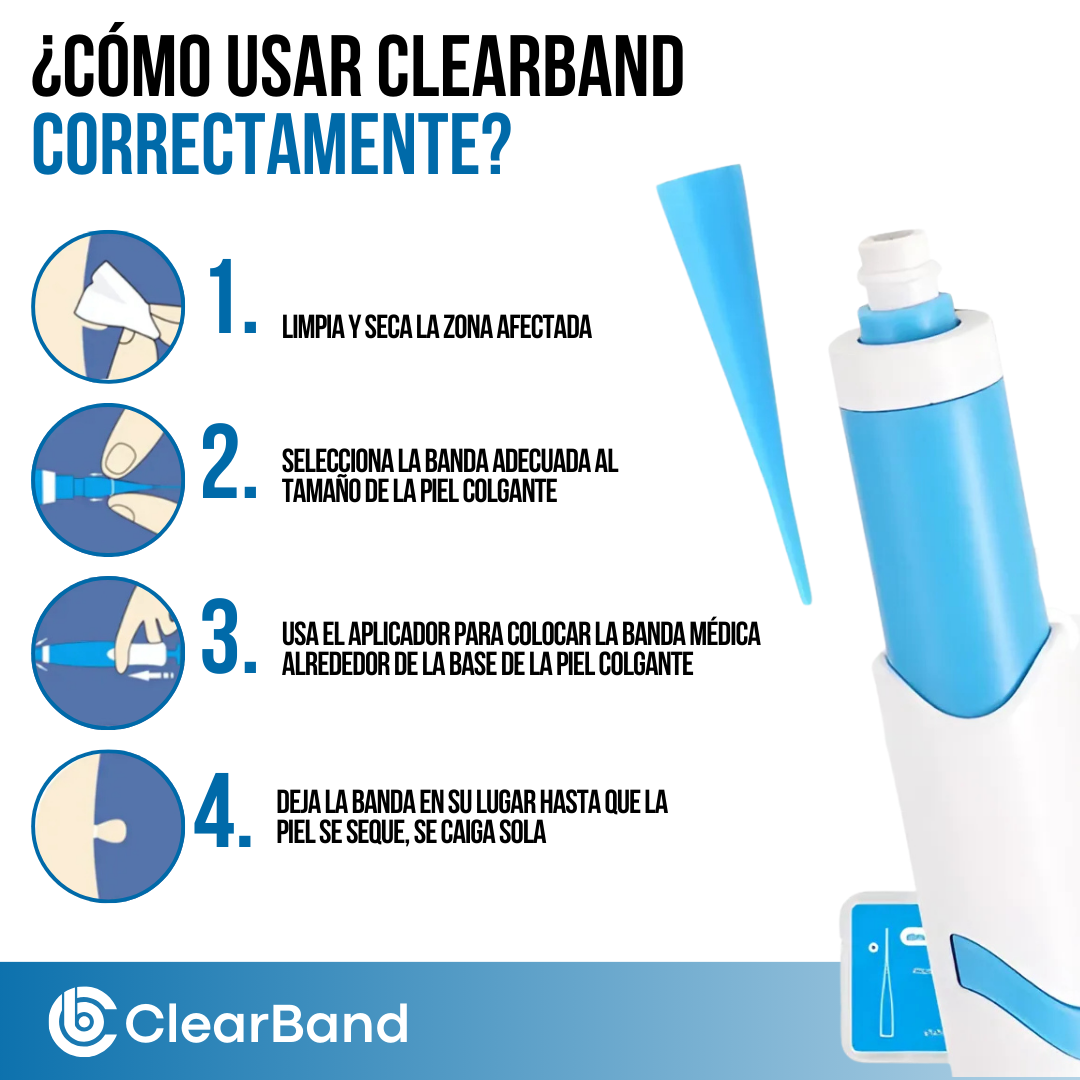 ClearBand™ - Elimina verrugas de forma natural y sin dolor