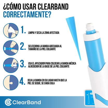 ClearBand™ - Elimina verrugas de forma natural y sin dolor