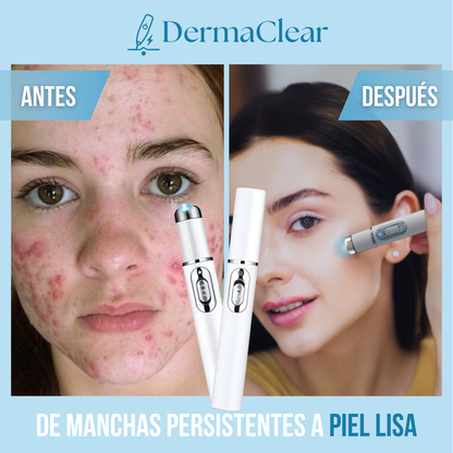 Dermaclear - Elimina imperfecciones al instante
