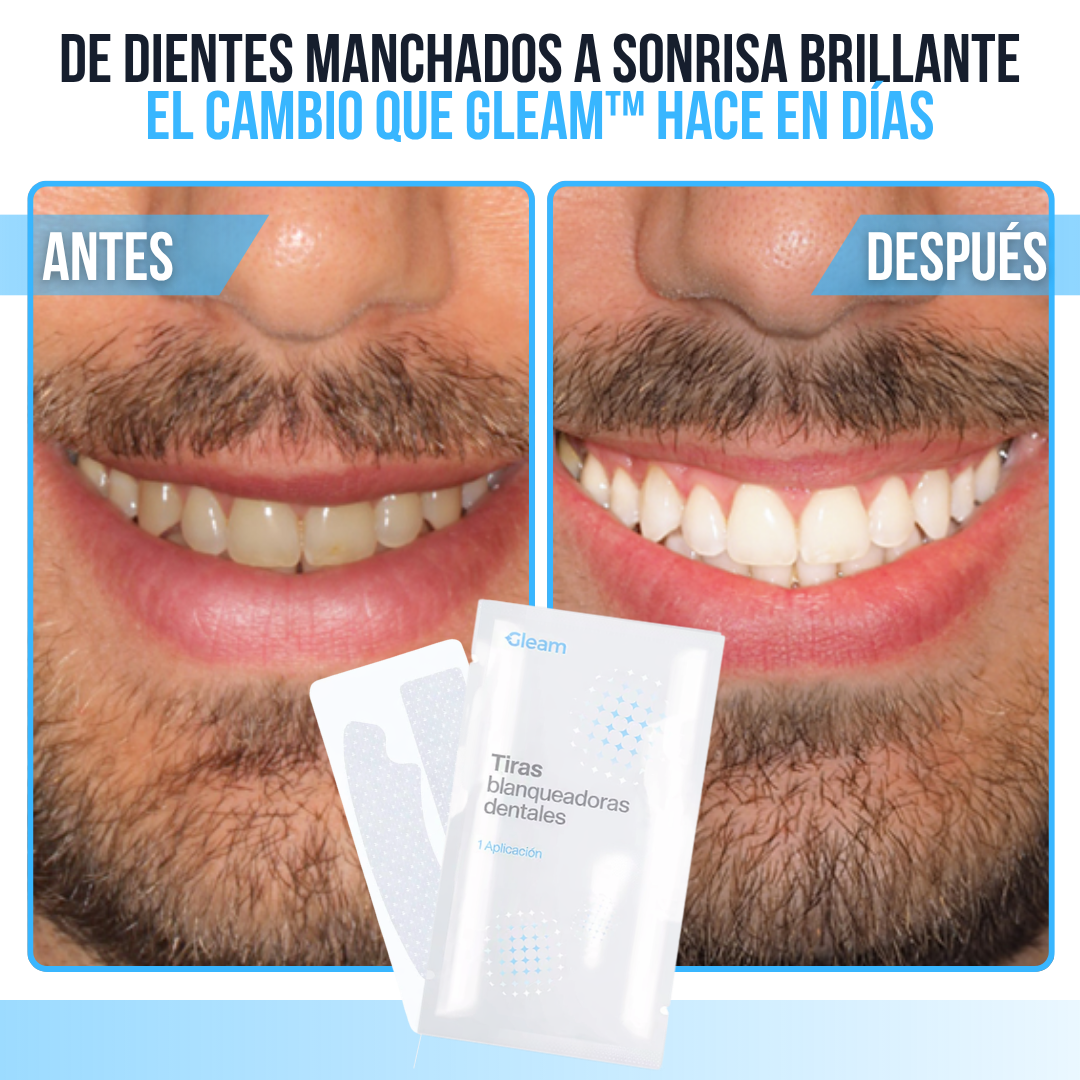 Gleam™ Tiras Blanqueadoras de Dientes | 2 Tonos Más Blanco en 30 Minutos.