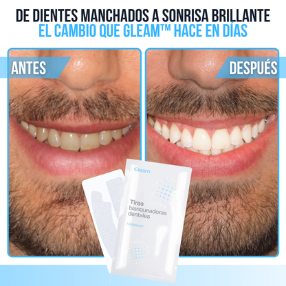 Gleam™ Tiras Blanqueadoras de Dientes | 2 Tonos Más Blanco en 30 Minutos.