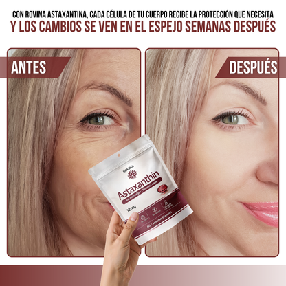 Rovina® | El Antioxidante Más Poderoso de la Naturaleza.