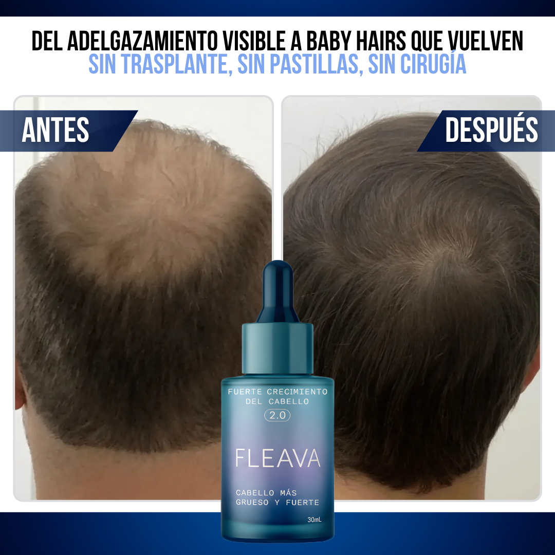 Fleava™ — Lo que el Minoxidil No Pudo Hacer