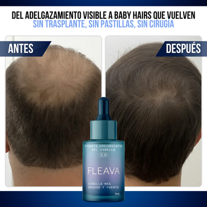 Fleava™ — Lo que el Minoxidil No Pudo Hacer