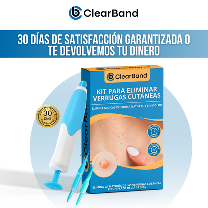 ClearBand™ - Elimina verrugas de forma natural y sin dolor