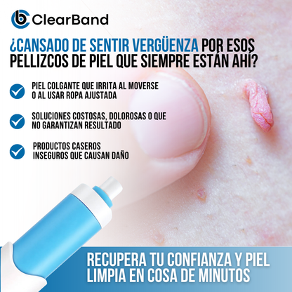 ClearBand™ - Elimina verrugas de forma natural y sin dolor