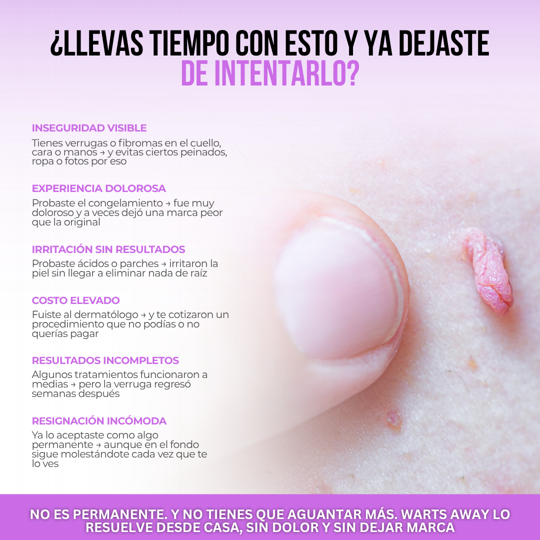 Wart Away™ Crema Eliminadora de Verrugas y Fibromas