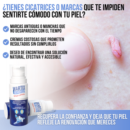 WARTIX REMOVER™ - Elimina verrugas y lunares con rapidez