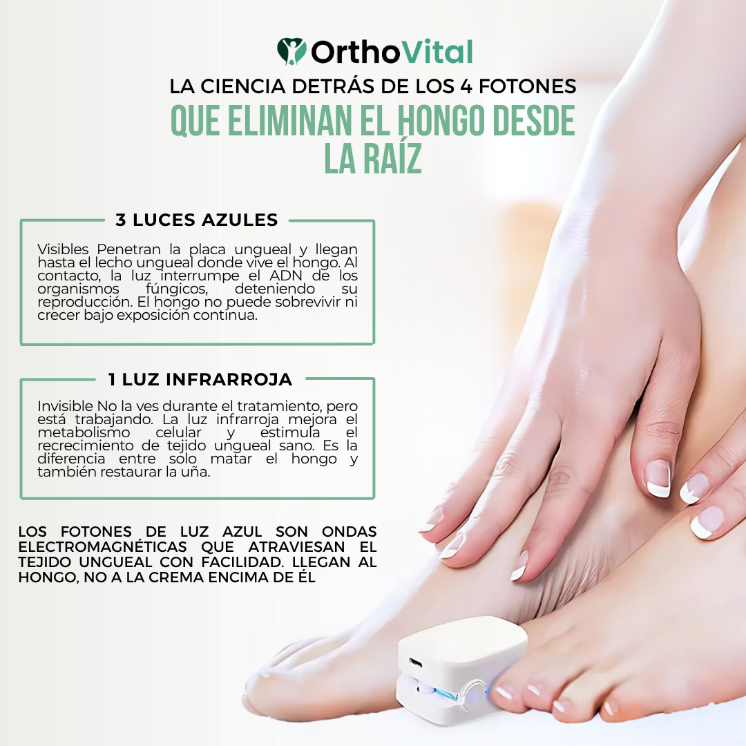 OrthoVital™ Dispositivo de Luz Azul para Hongos en Uñas | Las Cremas No Llegan al Hongo.